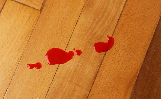 как удалить пятна крови с дивана